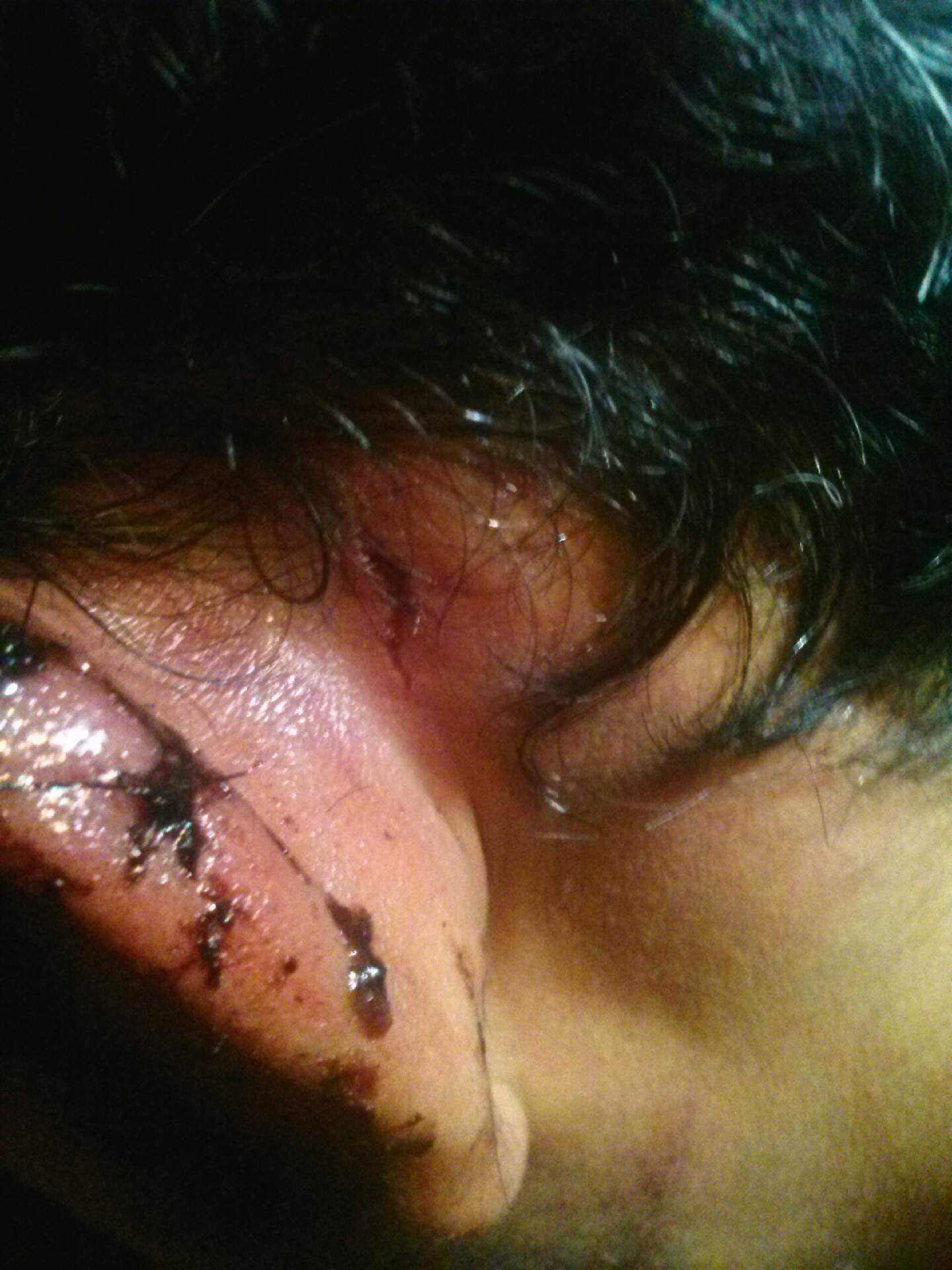 Diego Bara_2(Contributed Photo/Diego Bara) Diego Bara's injuries (Contributed Photo/Diego Bara)