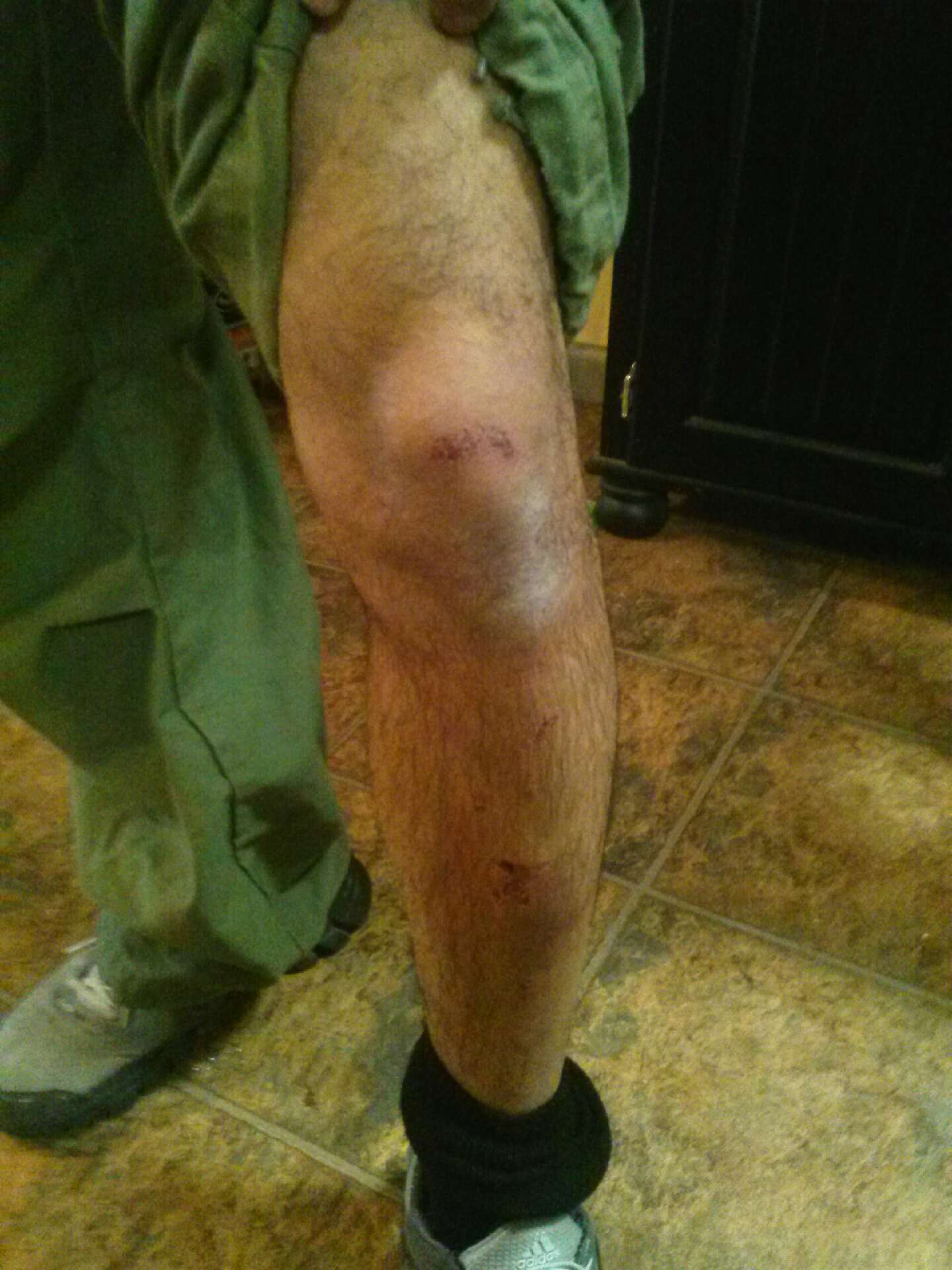 Diego Bara_3(Contributed Photo/Diego Bara) Diego Bara injuries Contributed Photo/Diego Bara)