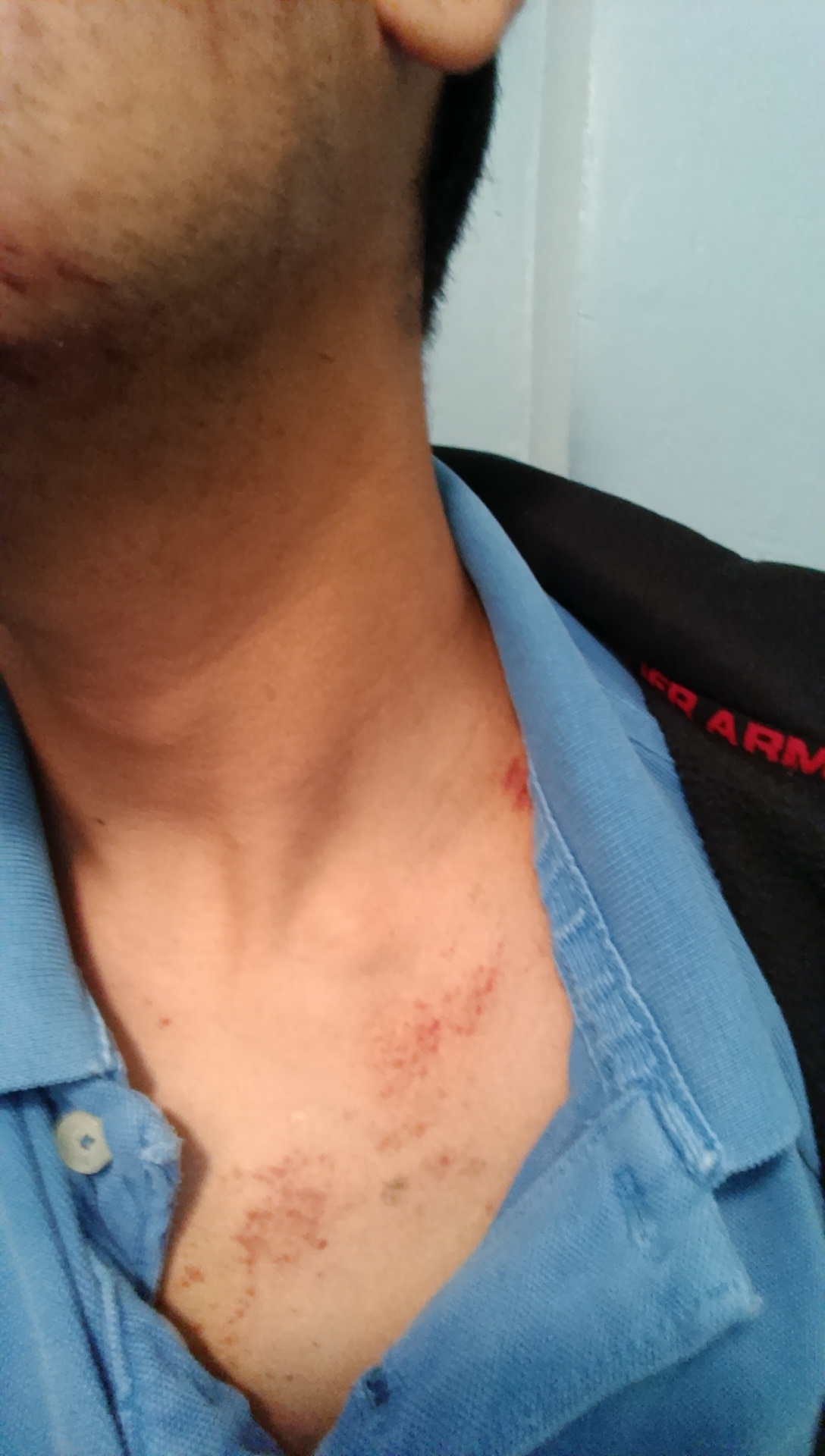 Dominic Bara_2 (Contributed Photo Diego Bara) Dominic Bara's injuries. (Contributed Photo Diego Bara)