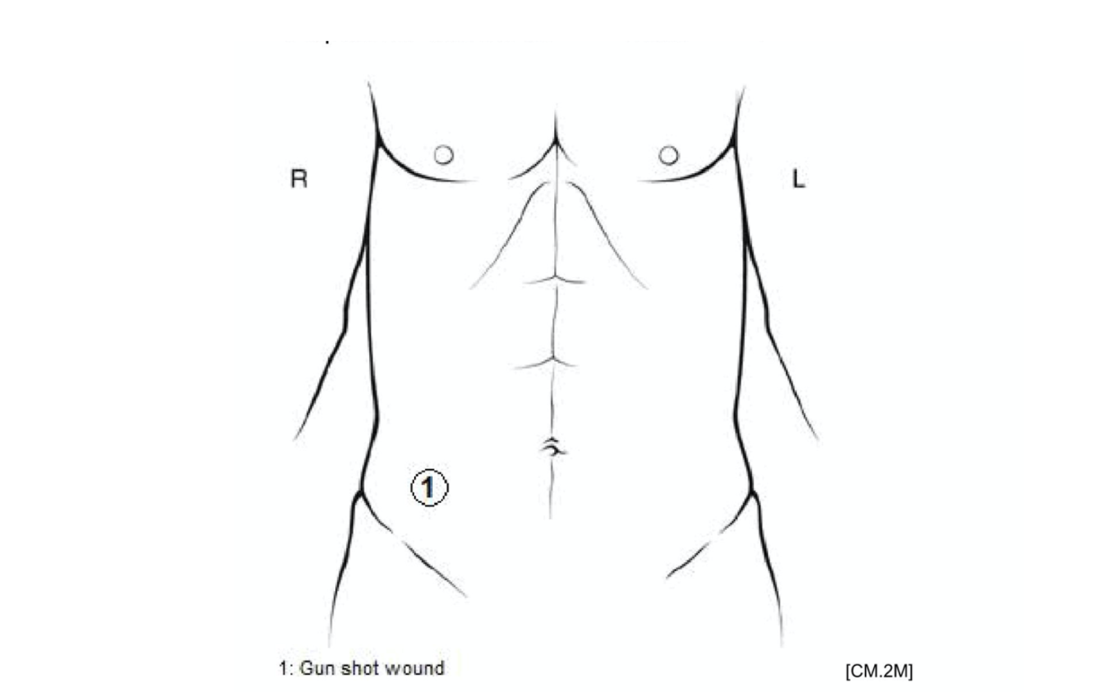 Report on the Shooting of Carlos Galvan