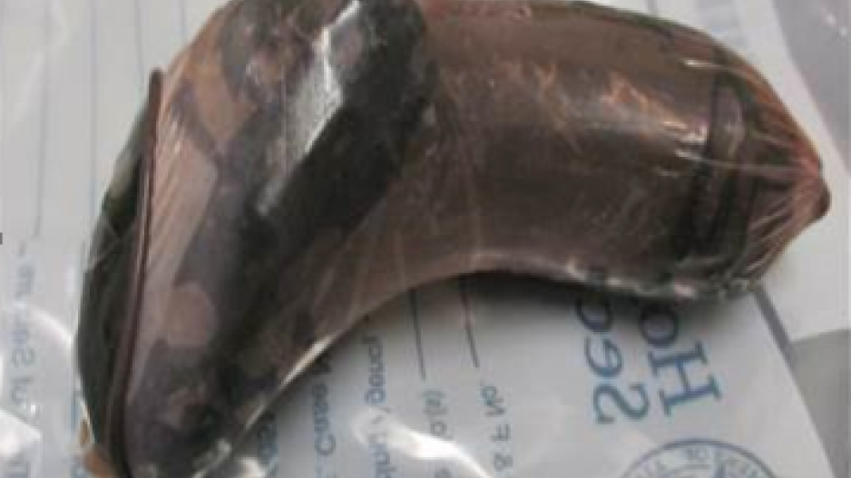 Fentanyl seized from a body cavity (Contributed/CBP) Fentanyl seized from a body cavity (Contributed/CBP)