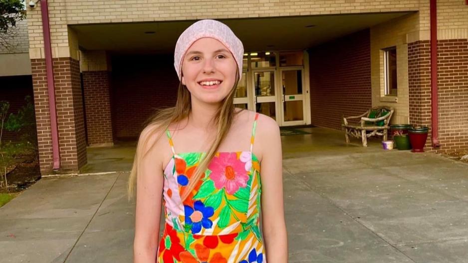 Meleah Plummer in Dallas prior to her second series of surgeries Meleah Plummer in Dallas prior to her second series of surgeries