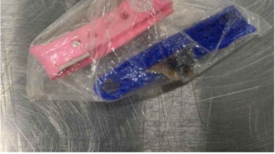 Umbilical Cord Found in Luggage (Contributed/CBP) Umbilical Cord Found in Luggage (Contributed/CBP)