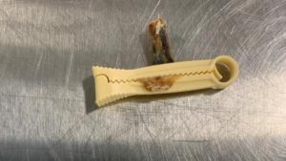 Umbilical Cord & Positive Pregnancy Test Found in Luggage (Contributed/CBP) Umbilical Cord & Positive Pregnancy Test Found in Luggage (Contributed/CBP)