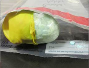 Fentanyl Package Smuggled Inside Woman's Body Cavity (Contributed/CBP)