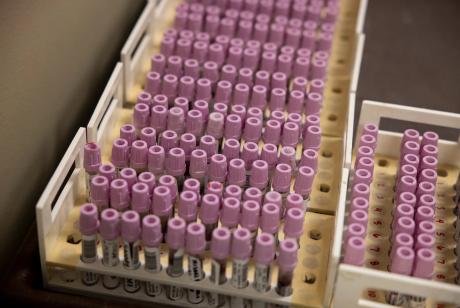 Patient blood samples, pictured here on May 1, 2025, that are ready for testing at the Texas Department of State Health Services Laboratory.
