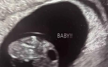 The fundraiser states that on Tuesday, Dec. 16, the family learned that the child the mother was carrying no longer had a heartbeat. The loss was described as “unimaginable,” according to the fundraiser, and the family said they are still processing their grief while managing day-to-day responsibilities.