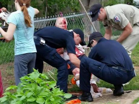 San Angelo EMS crews stabilize the victim of the dog attack on April 24, 2015. (COntributed/Rose Samaniego)