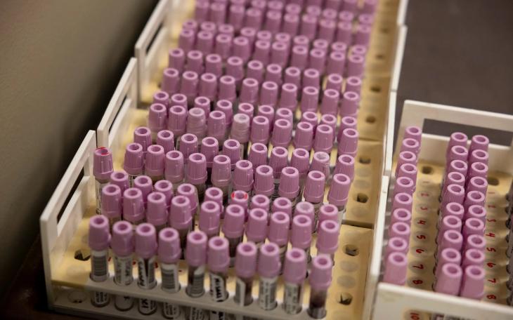 Patient blood samples, pictured here on May 1, 2025, that are ready for testing at the Texas Department of State Health Services Laboratory.