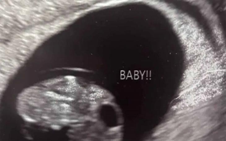 The fundraiser states that on Tuesday, Dec. 16, the family learned that the child the mother was carrying no longer had a heartbeat. The loss was described as “unimaginable,” according to the fundraiser, and the family said they are still processing their grief while managing day-to-day responsibilities.