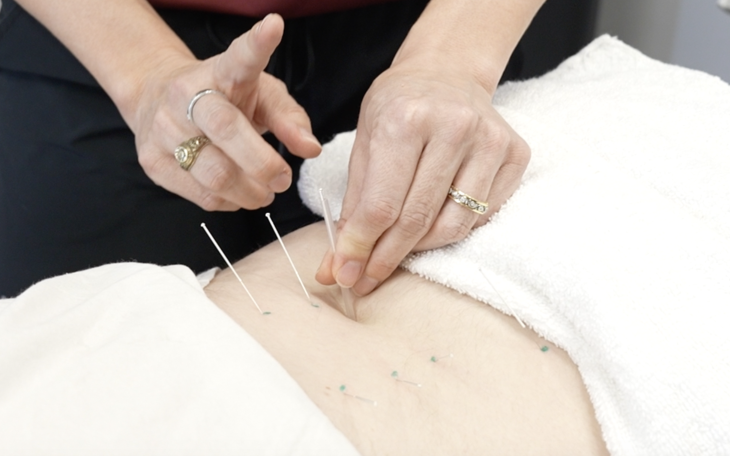 Dry Needling at Movement Therapy