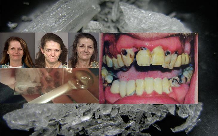 Side effects of meth use include rotting teeth, gaunt postures, aging and weight loss. (Photo courtesy of Google)