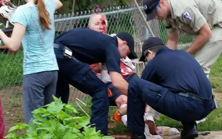 San Angelo EMS crews stabilize the victim of the dog attack on April 24, 2015. (COntributed/Rose Samaniego)