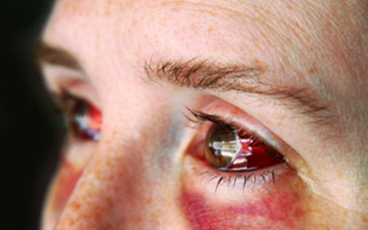 Domestic violence is estimated to rise in San Angelo throughout the holiday season. (Photo from iStock Photo)